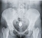 網紅色影大神『野叔+希威社+魔都+抖叔』五星推薦 露出性愛女神亂入 完美露臉 高清