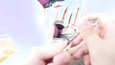 國產字母圈王者級女玩家下體開發天花板陰環少女【李小莫】私拍第五部：暴力子宮開發，用宮頸鉗塞入子宮，然後再子宮里插入三根金屬棒，最後直接把子宮插的變形了